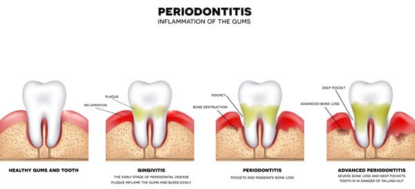 chest nut hill dental